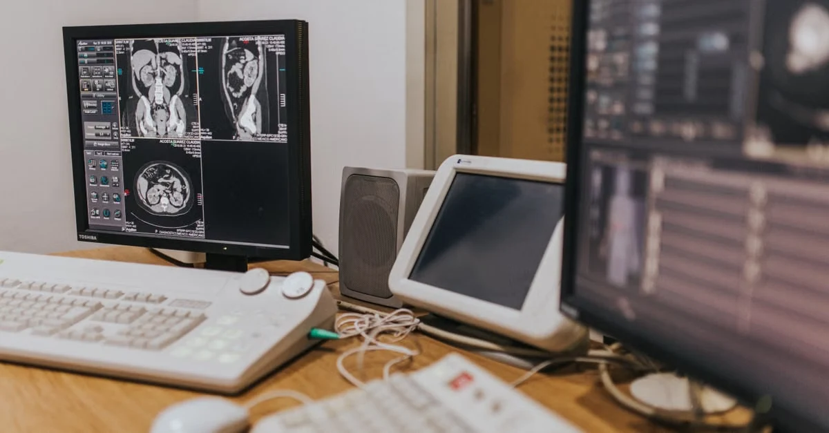 Medical imaging workstation showing MRI scans with revenue cycle management automation software displayed on multiple.