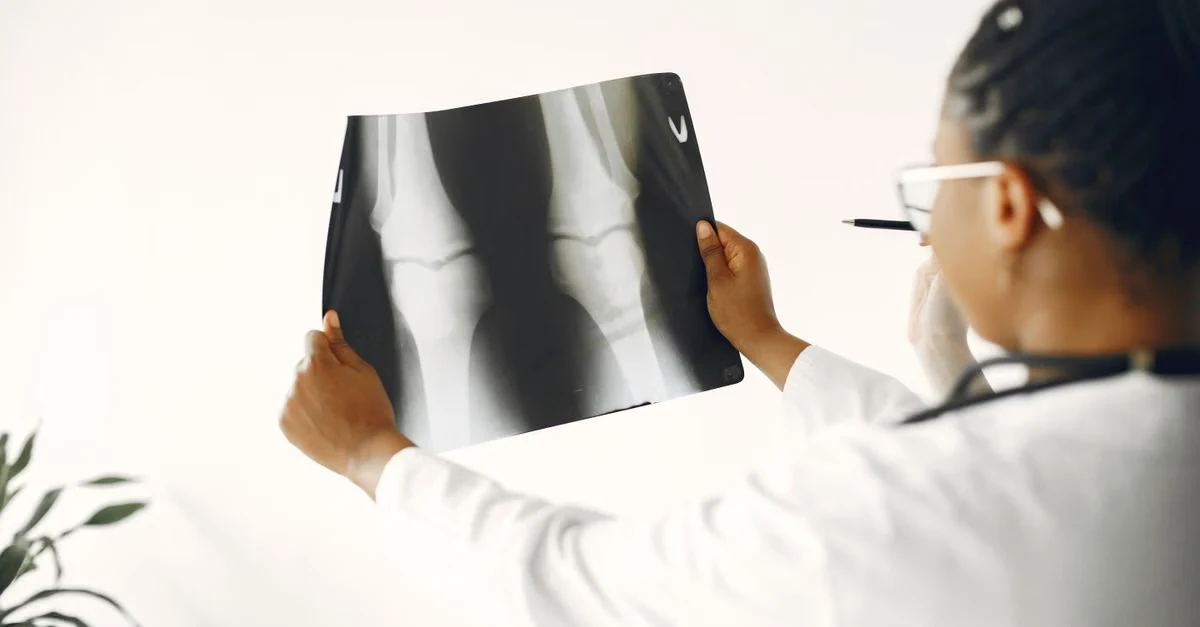Doctor examining X-ray image for orthopedic coding and diagnosis assessment.