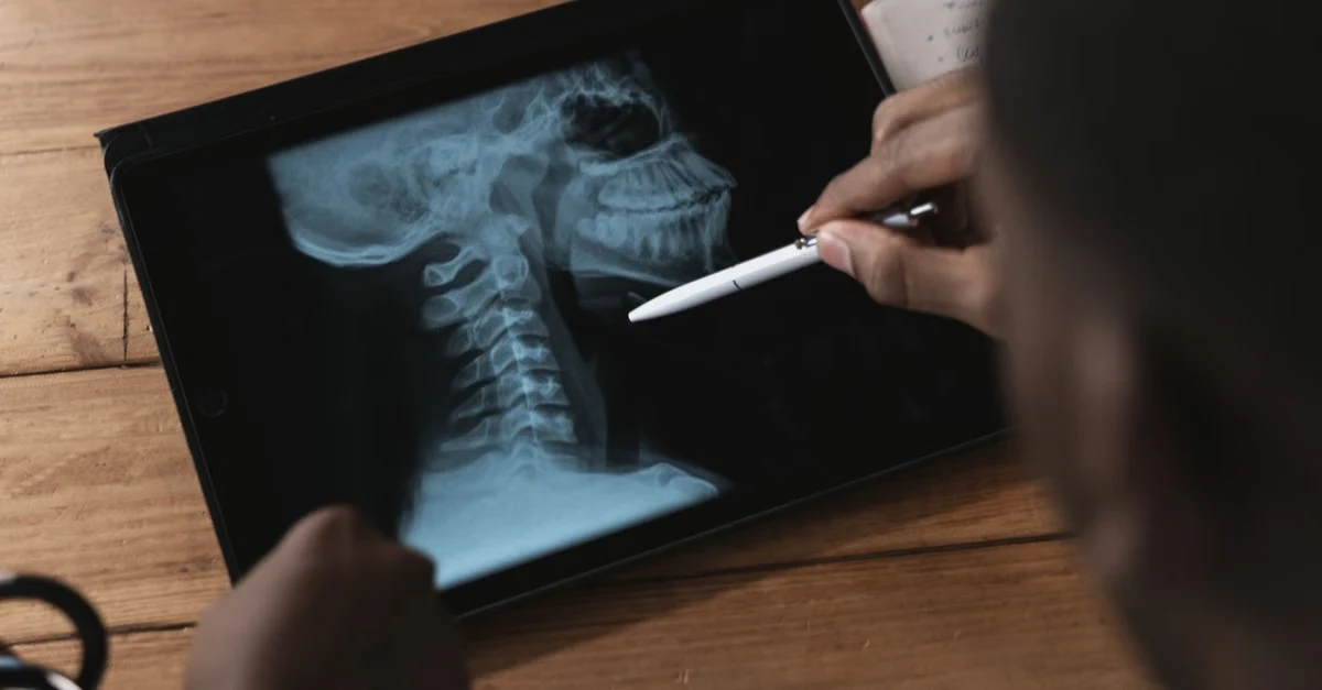 Doctor examining cervical spine X-ray with pointer for spine surgery coding assessment and diagnosis on wooden desk.